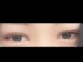 วิธีการเย็บแผล 1 มม. โดยผู้อำนวยการคิม ฮงจิน