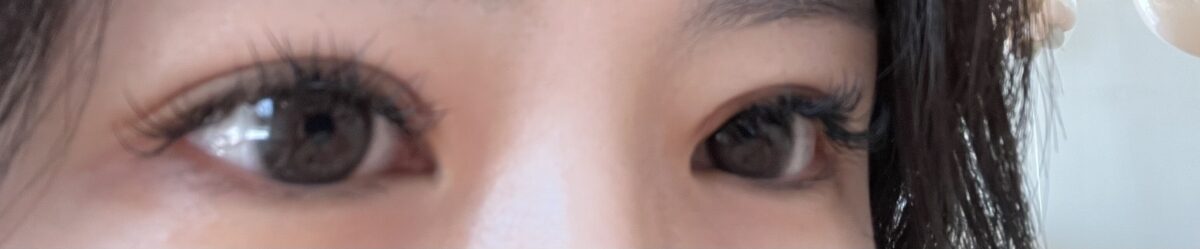 รีวิวการแก้ไขเปลือกตาโดย ดร.โด ออน-ร็อก