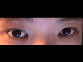 รีวิวการยกกระชับเปลือกตาบนด้วยวิธี Natural Adhesion ของคุณหมอคิม ฮงจิน