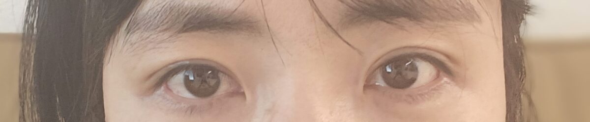 รีวิวการผ่าตัดแก้ไขแผลของ ดร.โด ออน-รก