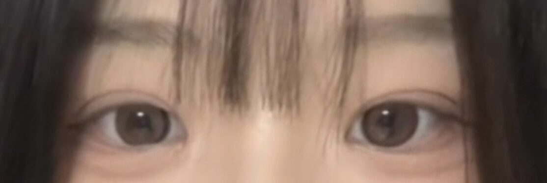 キム・ホンジン院長自然癒着レビュー