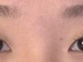 ฉันได้รับการรักษาด้วยวิธีธรรมชาติจากผู้อำนวยการคิม ฮงจิน