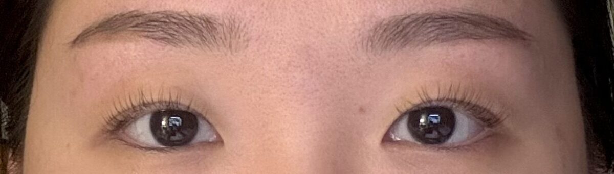 ฉันได้รับการรักษาด้วยวิธีธรรมชาติจากผู้อำนวยการคิม ฮงจิน