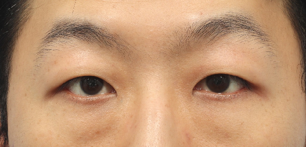 1mm整形外科+キム・ホンジン院長