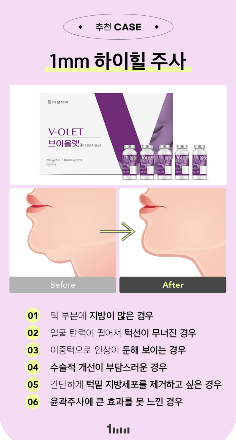 1mm Plastic Surgery: Double Chin Annihilation! High Heel Injection Event 사진 4
