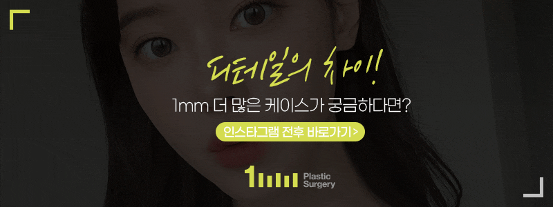 Become a Campus Goddess with Eye Surgery for Students at 1mm Plastic Surgery [CSAT Event] 사진 6
