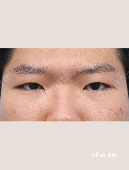 After