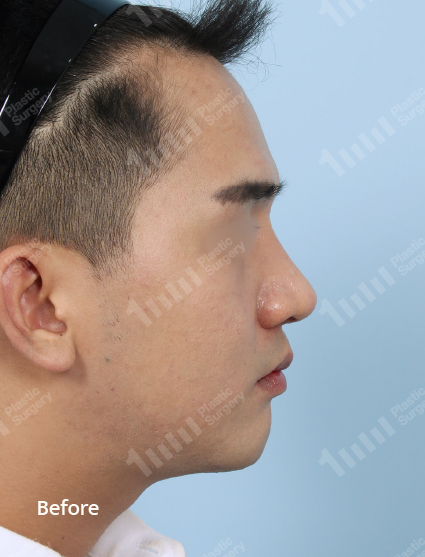 Before
