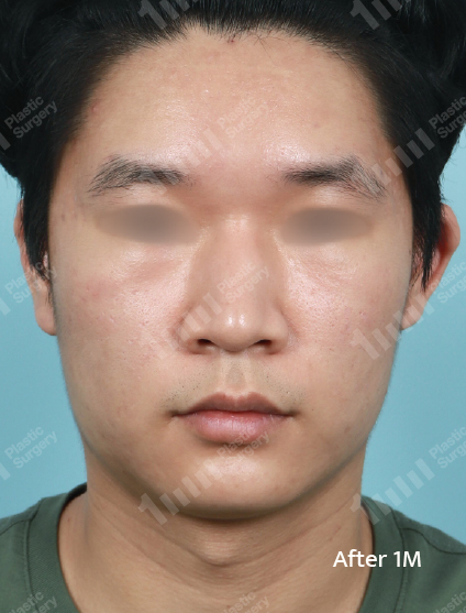 After