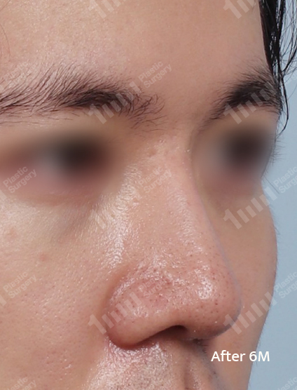 After