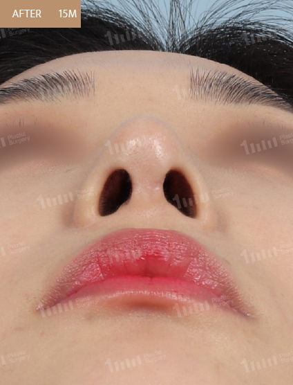 After