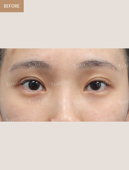 Before
