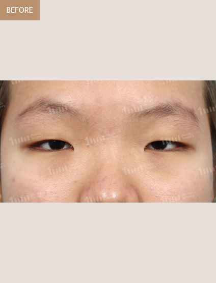 Before
