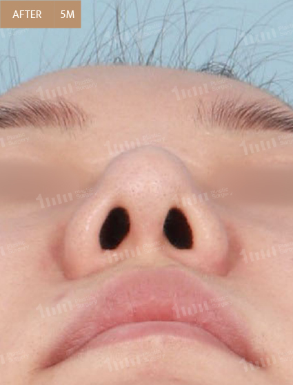 After