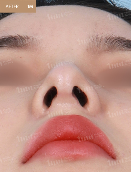 After