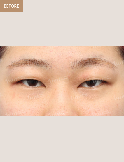Before