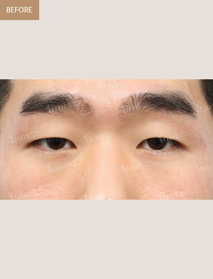 Before