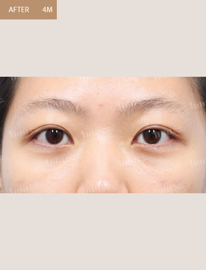 After