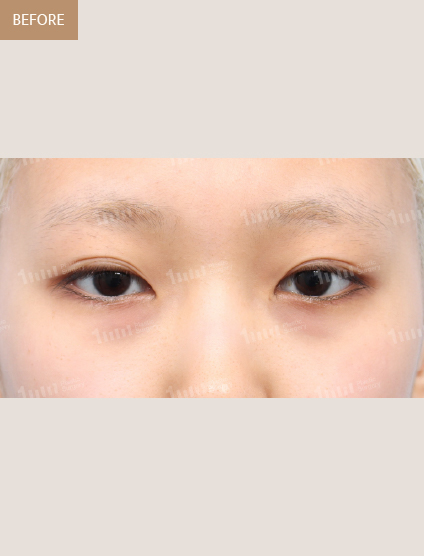 Before
