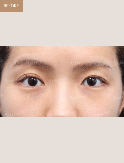 Before