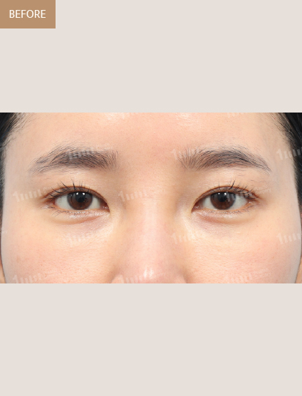 Before