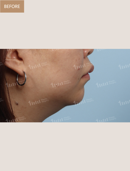 Before