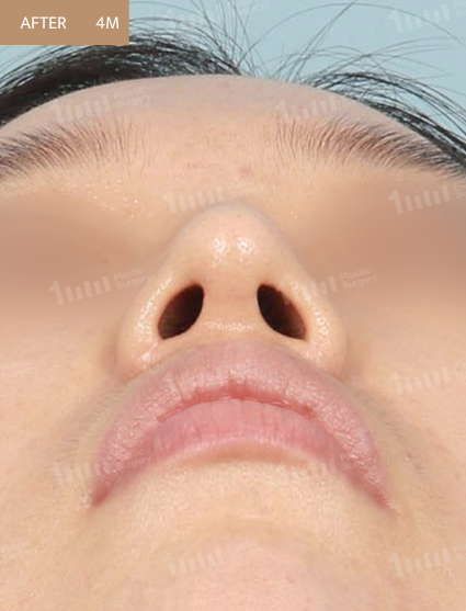 After