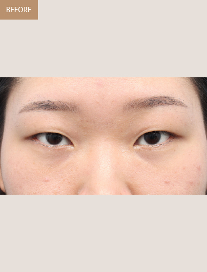 Before