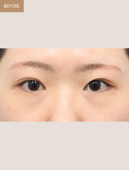 Before