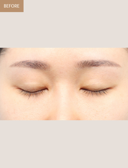 Before