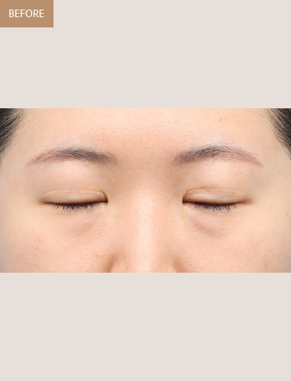 Before
