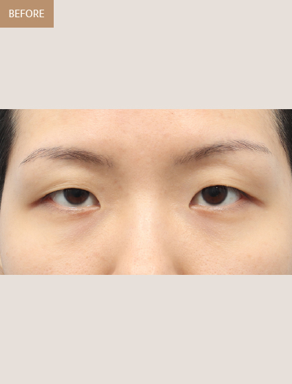 Before