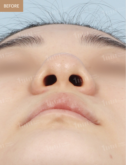 Before