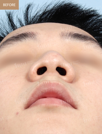 Before