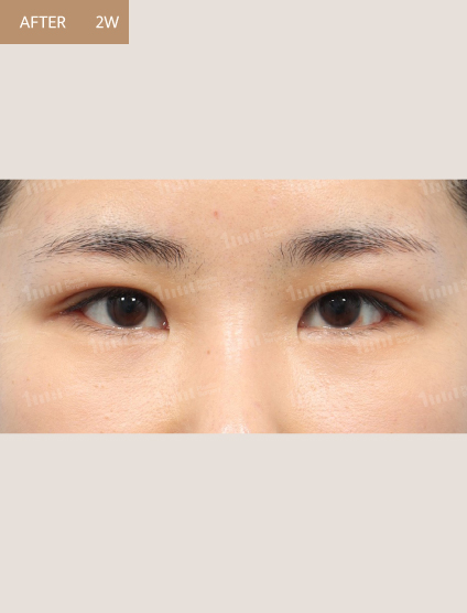 After