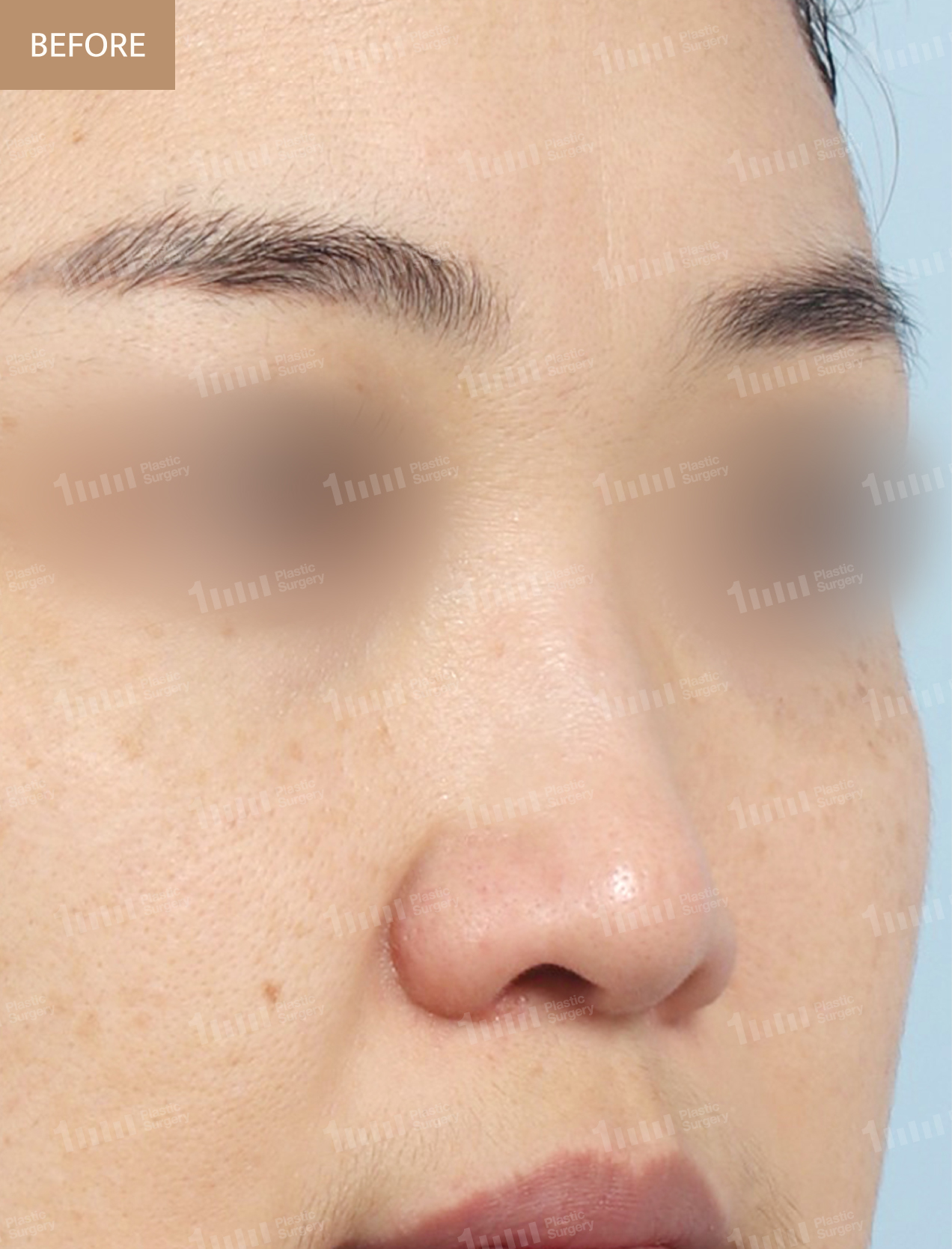 Before