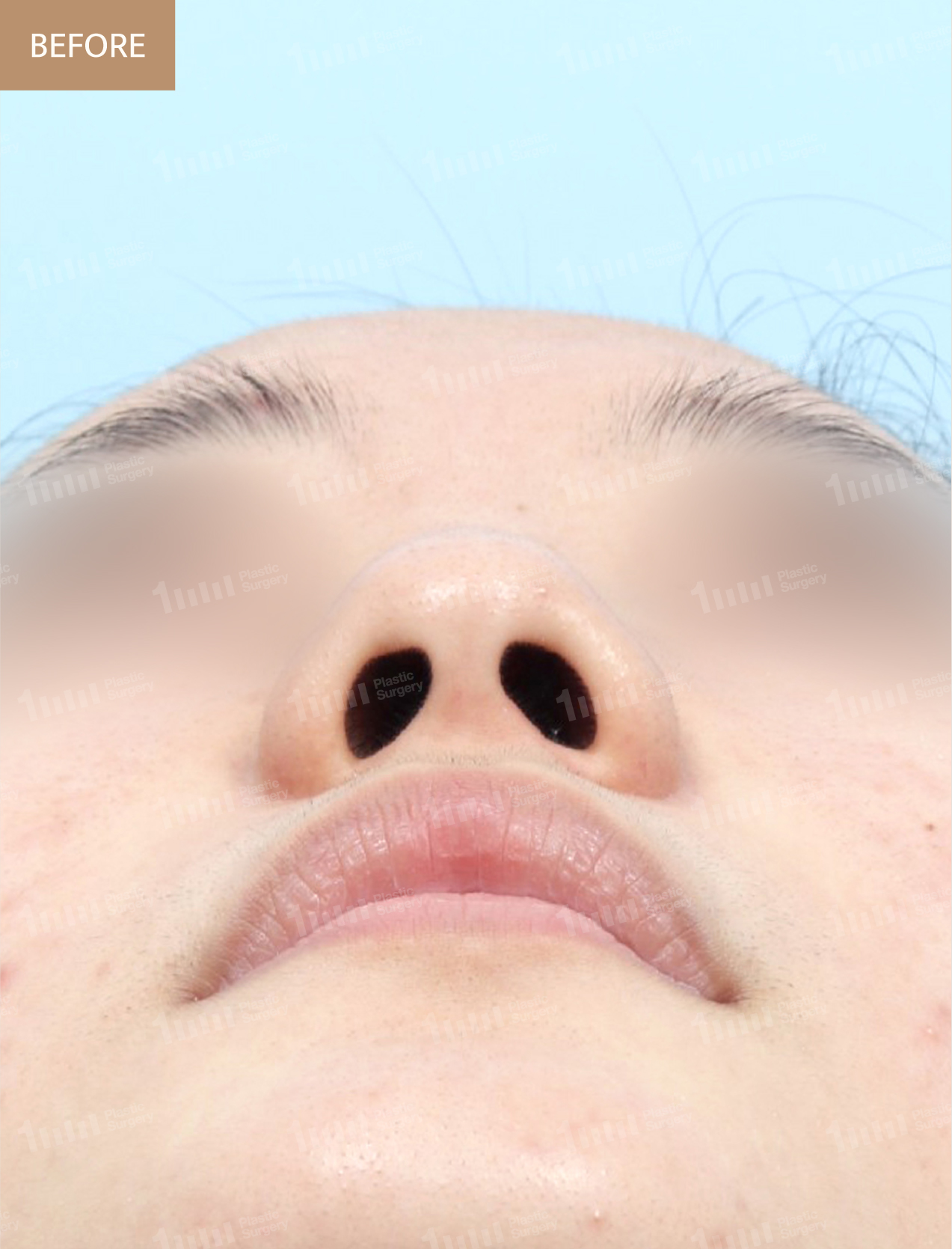 Before