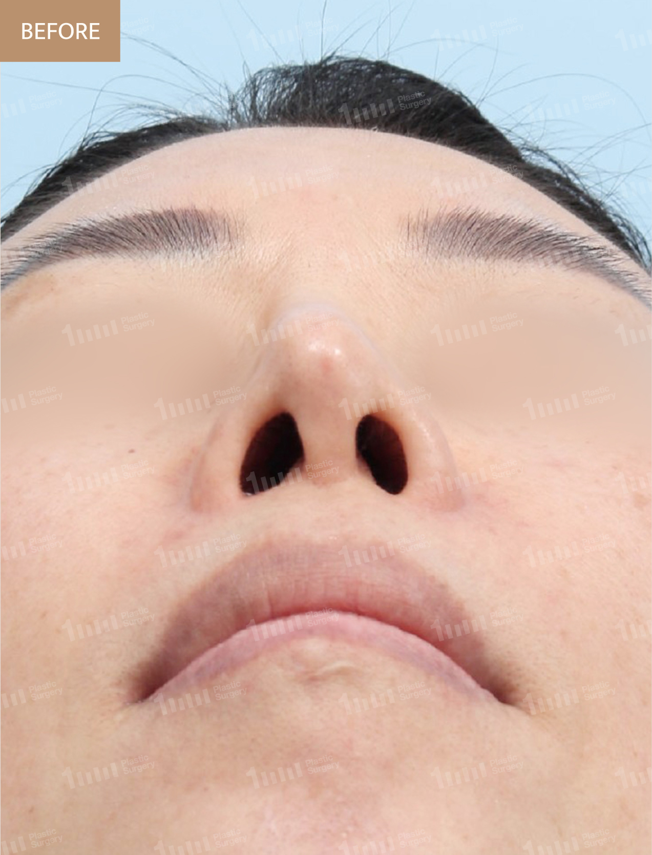 Before